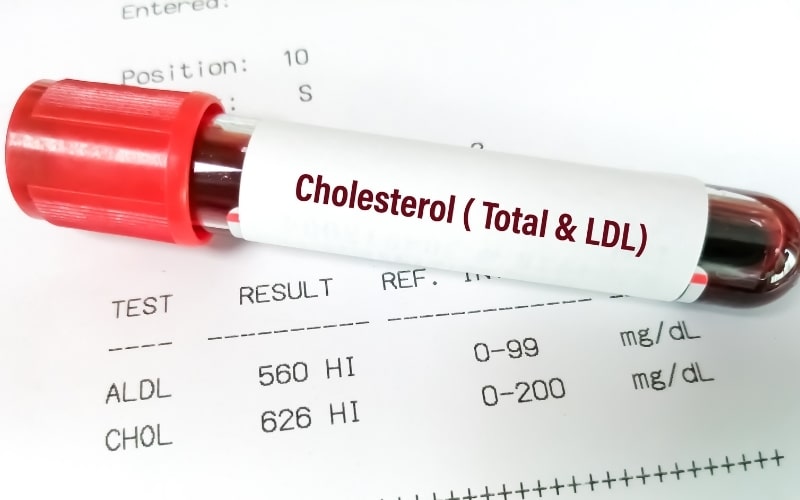 7-Day Low Cholesterol Diet Meal Plan